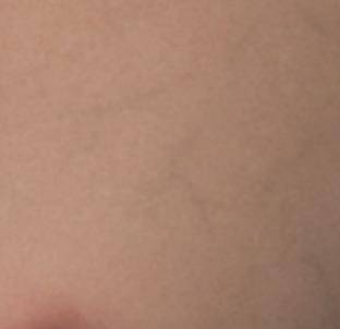 ADD VEINS (BREAST, BODY)