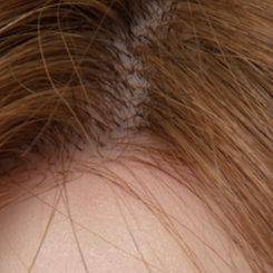 HAIR TYPE